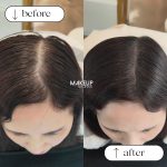 SMP for Crown/Parting